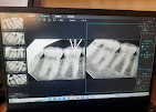 Digital dental scans used to assess and plan implant placement